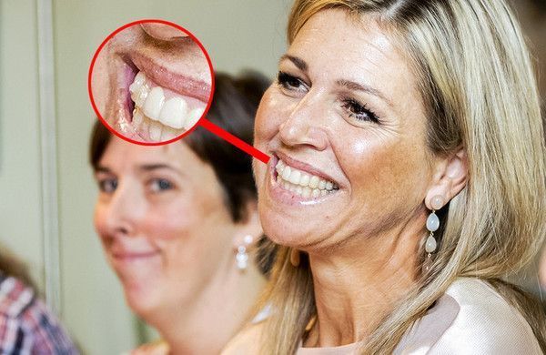 Orthodontie royale